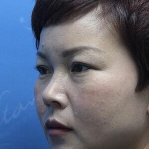 營口康藝謝靜半長期紋眉術(shù)后兩周左右的分享~